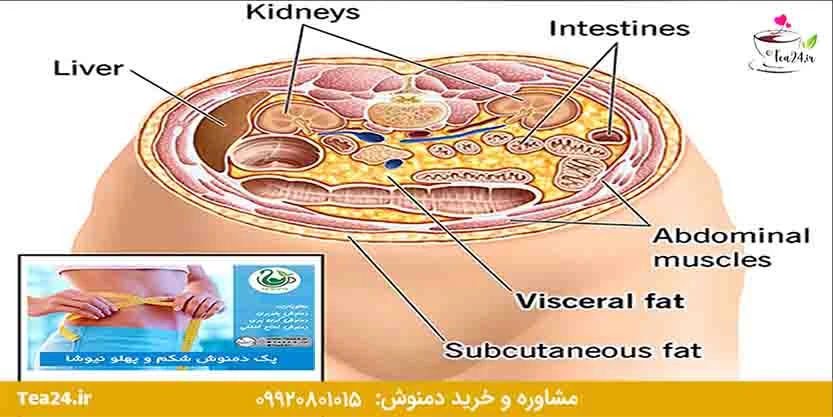 این تصویر چربی احشایی بدن را نشان می دهد
